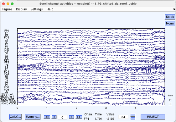 You should see recordings from each channel after the DC offset has been removed. (DC offset EEG recording systems refers to general low-frequency drift in the recordings due to the electrode-tissue interface.) Try finding some of the common artifacts like blinks/eye-movements, alpha waves, muscle noise